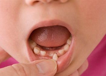 Hướng dẫn chi tiết quy trình nhổ răng sữa cho bé