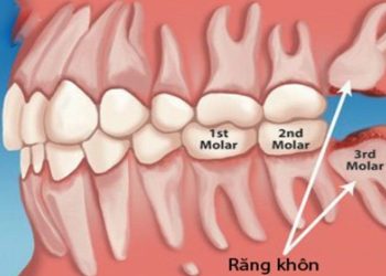 Vị trí của răng số 8 trong hàm.