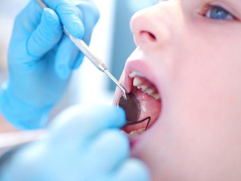 Tổng hợp các cách trị sâu răng cho bé nhanh chóng, hiệu quả