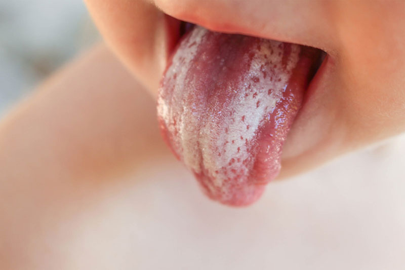 Trong dung dịch có thể đem lại những hiệu quả đáng ngờ trong việc làm sạch bề mặt lưỡi