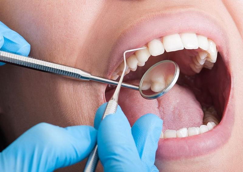 Người mắc bệnh về răng miệng cũng bị ê buốt sau khi cạo vôi