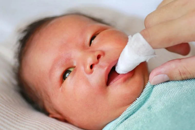 Rơ lưỡi cho bé thường xuyên để vệ sinh khoang miệng hạn chế nấm miệng ở trẻ