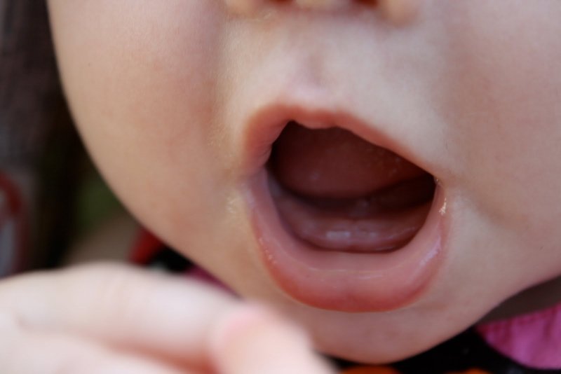 Tùy từng trường hợp mà bé bị chậm mọc răng có nguy hiểm hay không