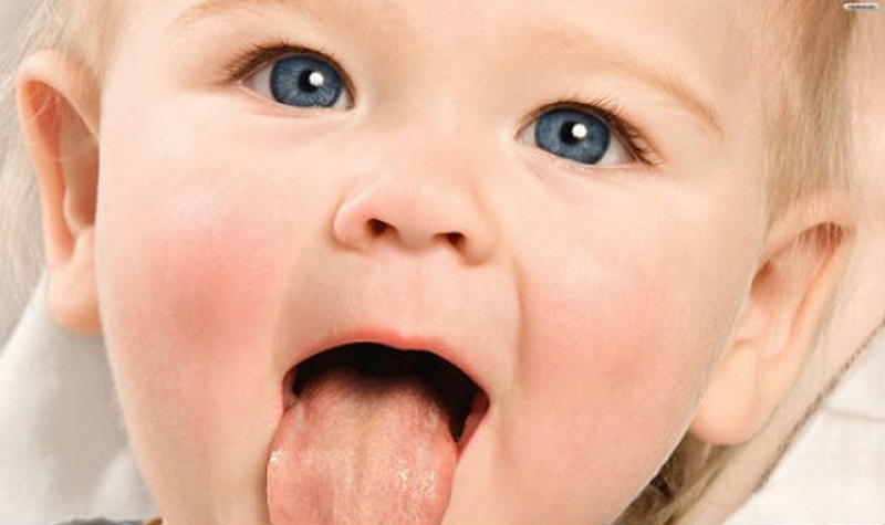 Tưa miệng là tình trạng nhiễm nấm xảy ra phổ biến ở niêm mạc miệng