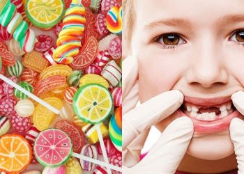Em bé ăn kẹo bị sâu răng cha mẹ nên xử lý như thế nào?