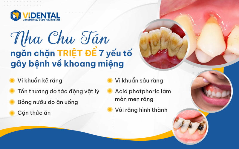 Nha Chu Tán hỗ trợ ngăn ngừa 7 yếu tố gây bệnh khoang miệng