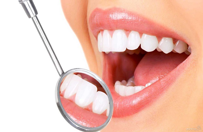 Bọc răng sứ phù hợp với trường hợp răng lệch vị trí ở mức độ nhẹ