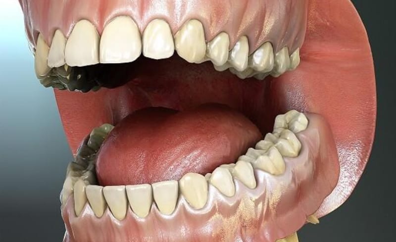 Răng cấm chỉ mọc một lần duy nhất trong đời