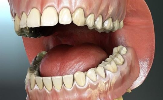 [Giải đáp nha khoa thú vị] Răng cấm và những câu hỏi thường gặp