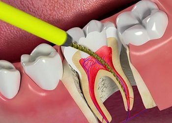 Tủy răng: Vai trò, cấu tạo và cách chăm sóc hiệu quả