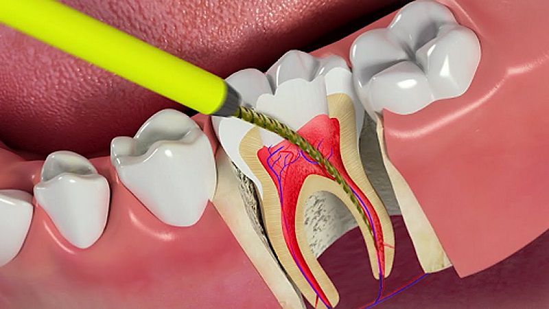 Tủy răng Mô đặc biệt của cấu trúc răng  YouMed