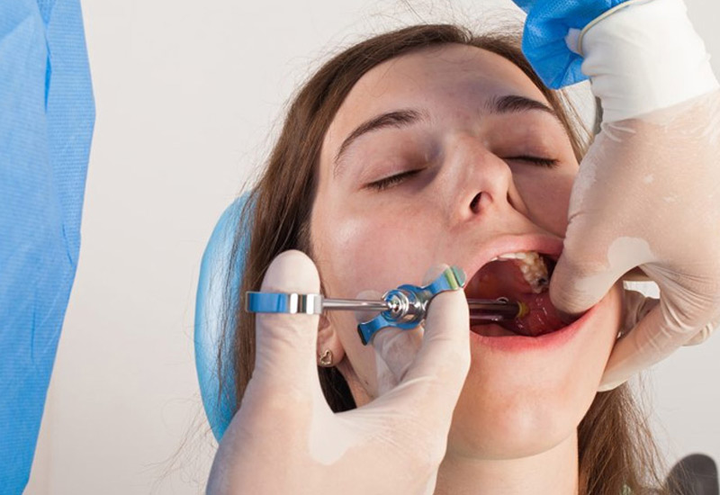 Trám răng là một kỹ thuật đơn giản được áp dụng để xử lý nhiều vấn đề về cấu trúc răng