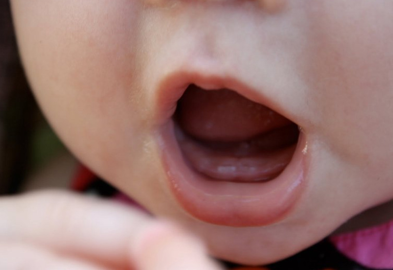 Trẻ 12 tháng chưa mọc răng có thể do nhiều nguyên nhân chủ quan