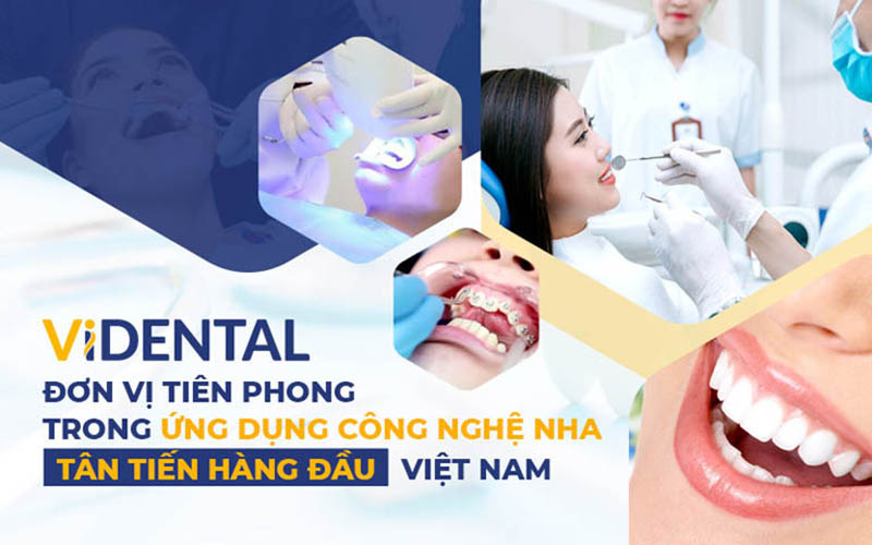 Trung tâm khám và điều trị bệnh răng miệng Vidental Care là đơn vị nha khoa uy tín khu vực quận Hà Đông