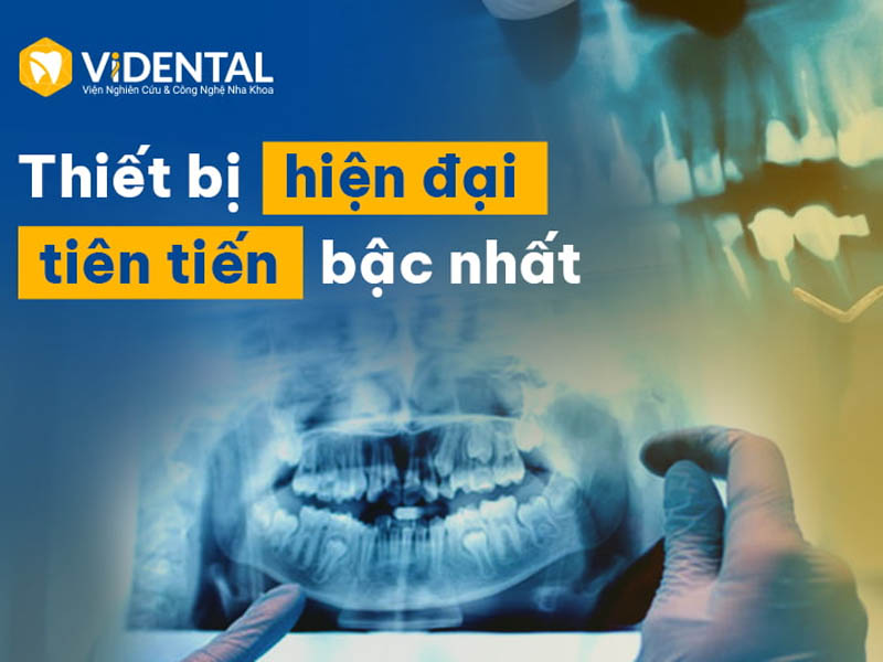 Vidental được trang bị rất nhiều thiết bị hiện đại phục vụ cho điều trị bệnh răng miệng