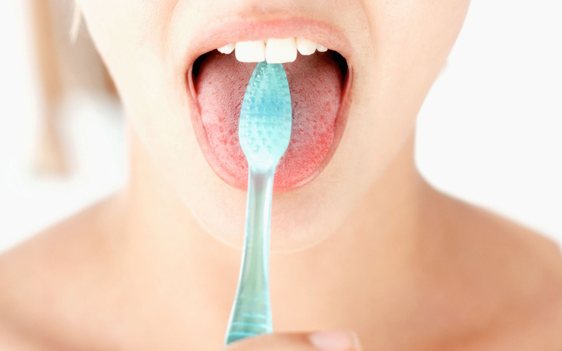 Một số lưu ý trong điều trị nấm lưỡi ở người nhiễm HIV